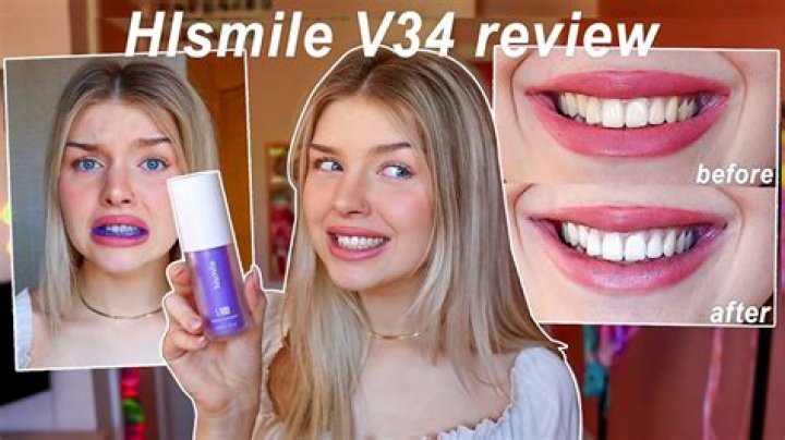 How Do You Use Hismile V34? – Celebrity