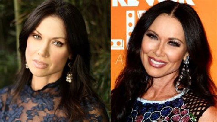 LeeAnne Locken Plastic Surgery